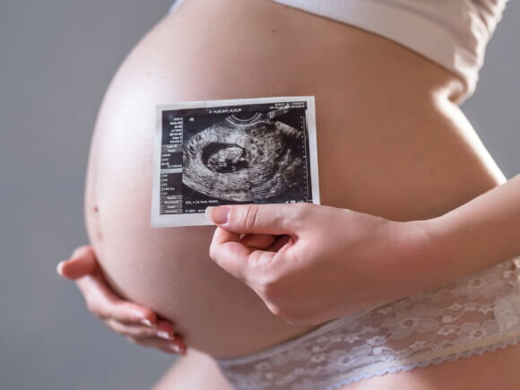 barriga grávida com uma das mãos posicionadas na barriga e a outra segurando a imagem de uma ultrassonografia