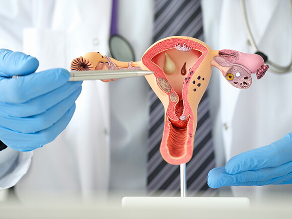 médico ginecologista segurando um útero de plástico emulando o processo de nidação