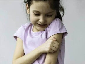 Imagem de uma criança coçando o próprio braço, a coceira pode ser um dos sintomas de alergia emocional.