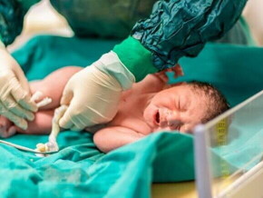 Um profissional de saúde realizando o procedimento de clampeamento do cordão umbilical de um bebê recém-nascido.