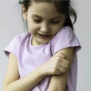 Imagem de uma criança coçando o próprio braço, a coceira pode ser um dos sintomas de alergia emocional.