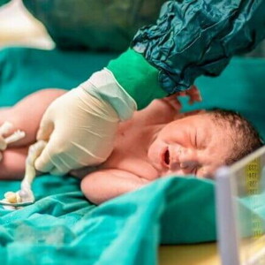 Um profissional de saúde realizando o procedimento de clampeamento do cordão umbilical de um bebê recém-nascido. Um profissional de saúde realizando o procedimento de clampeamento do cordão umbilical de um bebê recém-nascido.