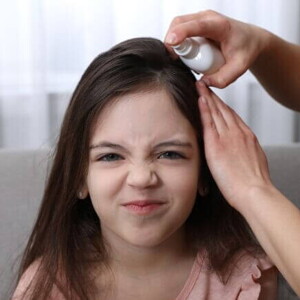 Menina com rosto irritado recebendo uma medicação no couro cabeludo