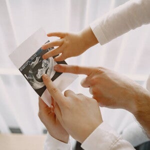 familia observa imagem de ultrassonografia sindrome edwards familia observa imagem de ultrassonografia sindrome edwards