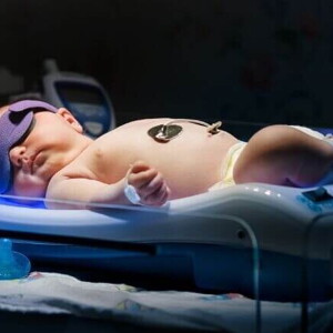 Recém-nascido passando por um procedimento de fototerapia neonatal.