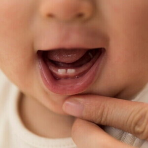 Close-up da boca de um bebê mostrando os primeiros dentinhos. Close-up da boca de um bebê mostrando os primeiros dentinhos.