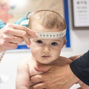 Profissionais de saúde medem a circunferência da cabeça de um bebê utilizando uma fita métrica, durante uma consulta de acompanhamento do desenvolvimento infantil.
