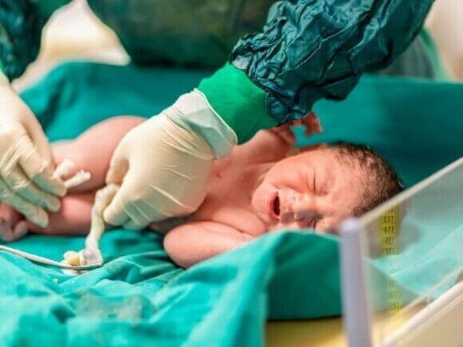 Um profissional de saúde realizando o procedimento de clampeamento do cordão umbilical de um bebê recém-nascido. Um profissional de saúde realizando o procedimento de clampeamento do cordão umbilical de um bebê recém-nascido.