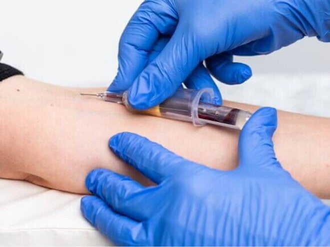Profissional usando luvas azuis realizando coleta de sangue no braço de uma pessoa com uma seringa. Profissional usando luvas azuis realizando coleta de sangue no braço de uma pessoa com uma seringa.