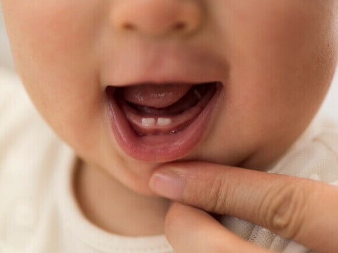 Close-up da boca de um bebê mostrando os primeiros dentinhos.