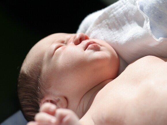 Icterícia neonatal: o que é, qual o tratamento indicado e outras informações