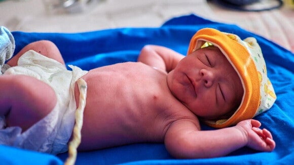 Um bebê recém-nascido deitado, com o cordão umbilical ainda intacto. Um bebê recém-nascido deitado, com o cordão umbilical ainda intacto.