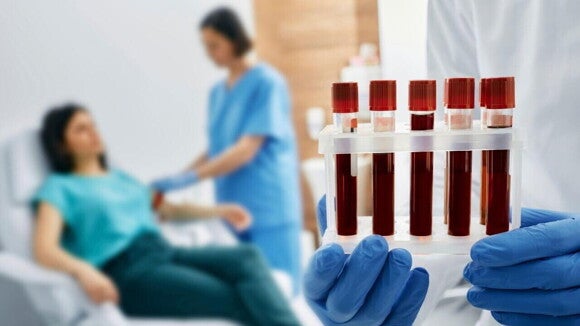 Profissional de saúde segurando tubos de ensaio com amostras de sangue em um laboratório, enquanto uma paciente realiza coleta de sangue ao fundo. Profissional de saúde segurando tubos de ensaio com amostras de sangue em um laboratório, enquanto uma paciente realiza coleta de sangue ao fundo.