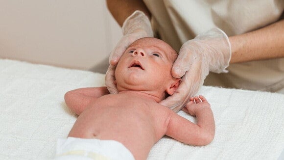 Profissional de saúde realiza avaliação da cabeça de um bebê deitado de barriga para cima sobre uma superfície macia, utilizando luvas descartáveis para examinar cuidadosamente a região do crânio. Profissional de saúde realiza avaliação da cabeça de um bebê deitado de barriga para cima sobre uma superfície macia, utilizando luvas descartáveis para examinar cuidadosamente a região do crânio.
