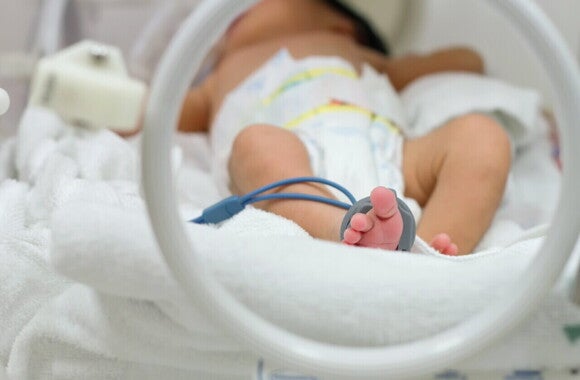 Um recém-nascido deitado em uma incubadora ou berço hospitalar. Um recém-nascido deitado em uma incubadora ou berço hospitalar.