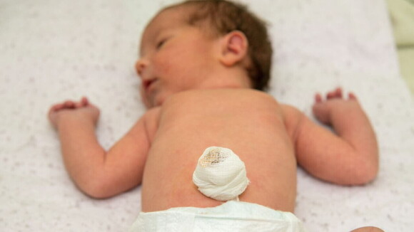 Bebê deitado com um curativo no umbigo. Bebê deitado com um curativo no umbigo.